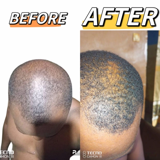 hair growth oil