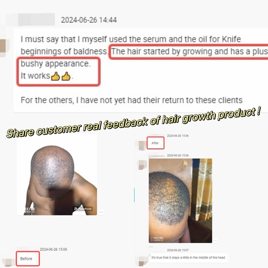 hair oil for hair growth